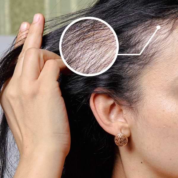 Crecimiento del cabello durante la menopausia