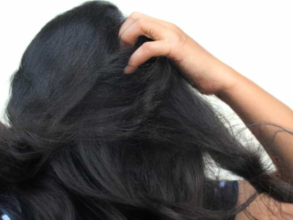 El estrés y la caída del cabello